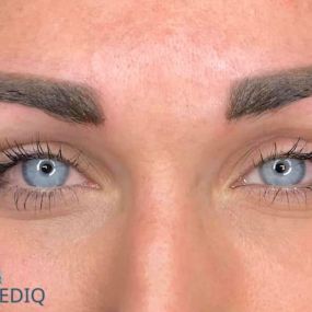 Cosmediq:
permanente make up behandeling