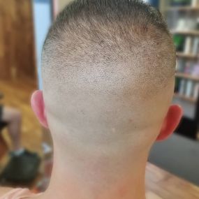 Mid-High Bald Fade Back View