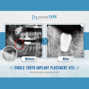 MacArthur Park Dentistry - Family Emergency Dental Implants Invisalign Dentist in Las Colinas & Irving, TX 75073
