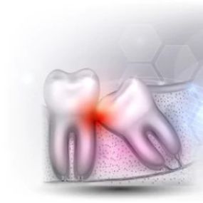 At Katy Center for Oral & Facial Surgery, we perform Wisdom Teeth Removal