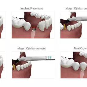 Bild von Elevated Oral & Implant Surgery, P.C.