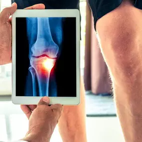 Since 2010, the orthopedic surgeons in Hampton, VA, have provided the comprehensive health care patients need to live a healthier, happier life.

From outpatient surgical care to knee replacement and hip replacement to back injury, we work around the clock to help resolve your various medical concerns.