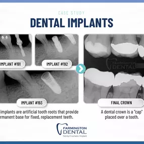 Farmington Dental Care of Beaverton Family, Cosmetic, Implants, 14425 Southwest Allen Boulevard #1 Beaverton, OR 97005