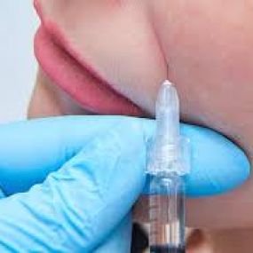 Injections BOTOX +FILLERS Visage