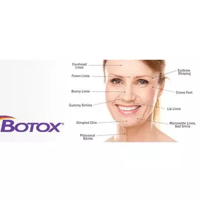 Botox has very many benefits to the face. Check out all of the different changes it can do. Call to discuss with a professional.