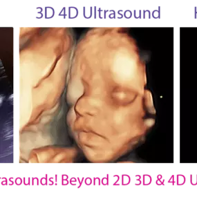 4D Baby is an Ultrasound Studio that provides a personal experience and allows expectant mothers and their loved ones the time to view and form a connection with their unborn baby during sessions that are totally dedicated to them in a comfortable, relaxing, and intimate setting where they will be able to receive images, videos, watch their baby move, yawn, wiggle its fingers and toes and much more. We strive to provide our clients with a memorable experience.