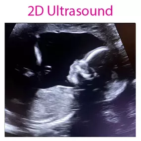 4D Baby is an Ultrasound Studio that provides a personal experience and allows expectant mothers and their loved ones the time to view and form a connection with their unborn baby during sessions that are totally dedicated to them in a comfortable, relaxing, and intimate setting where they will be able to receive images, videos, watch their baby move, yawn, wiggle its fingers and toes and much more. We strive to provide our clients with a memorable experience.