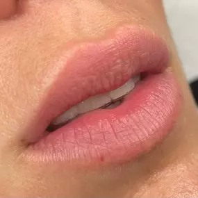 hidratacion-labial-san-fernando.jpeg
