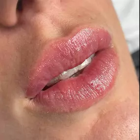 labios-san-fernando.jpeg