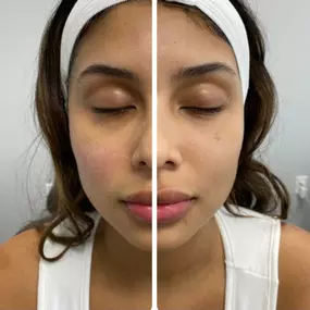 Bild von Skin Tightening, Botox and Lip Fillers by Skinsation LA