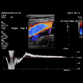 Bild von Truffles Vein Specialists