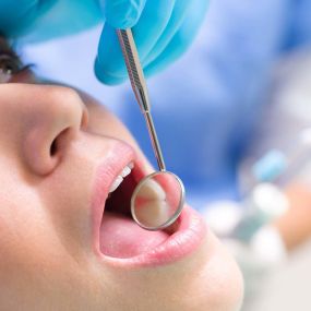 We treat all our patients will gentle, compassionate care at The Dental Hub of Bexley.
