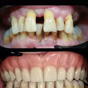 dentalium2.jpg