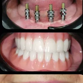 dentalium1.jpg