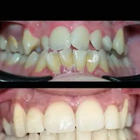 dentalium3.jpg