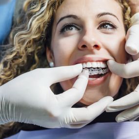 Best Dentist Santa Barbara