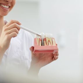 Teeth Whitening Santa Barbara