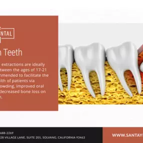 Best Dentist Santa Barbara