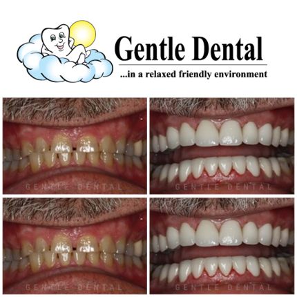 Logotipo de Gentle Dental - Commack