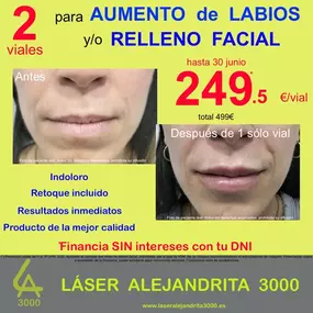 225072404-1-oPln00rhNX1749577338257.png