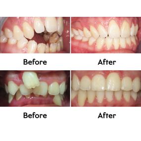 Bild von Dentist Huntington Beach CA - Dr. Sam Ayoub, DDS