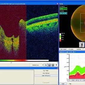 Bild von Insight Eye Clinic