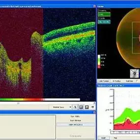 Bild von Insight Eye Clinic