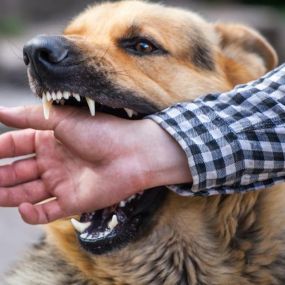 If you have suffered an injury due to an animal attack or dog bite, our knowledgeable personal injury attorneys are here to help. Backed by more than 60 years of combined experience, we help make sure you receive the compensation you deserve. Our trusted attorneys focus on settling your claim quickly and efficiently with the maximum recovery possible under the law.