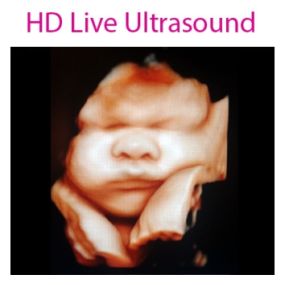 4D Baby is an Ultrasound Studio that provides a personal experience and allows expectant mothers and their loved ones the time to view and form a connection with their unborn baby during sessions that are totally dedicated to them in a comfortable, relaxing, and intimate setting where they will be able to receive images, videos, watch their baby move, yawn, wiggle its fingers and toes and much more. We strive to provide our clients with a memorable experience.