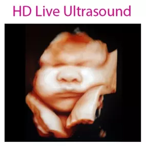 4D Baby is an Ultrasound Studio that provides a personal experience and allows expectant mothers and their loved ones the time to view and form a connection with their unborn baby during sessions that are totally dedicated to them in a comfortable, relaxing, and intimate setting where they will be able to receive images, videos, watch their baby move, yawn, wiggle its fingers and toes and much more. We strive to provide our clients with a memorable experience.