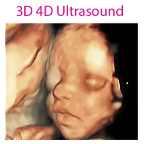 4D Baby is an Ultrasound Studio that provides a personal experience and allows expectant mothers and their loved ones the time to view and form a connection with their unborn baby during sessions that are totally dedicated to them in a comfortable, relaxing, and intimate setting where they will be able to receive images, videos, watch their baby move, yawn, wiggle its fingers and toes and much more. We strive to provide our clients with a memorable experience.