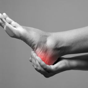 Heel pain is not usually caused by a single injury, such as a twist or fall, but from repetitive stress and pounding of the heel.
