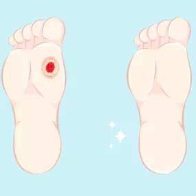 Many bunions will never cause problems, but some may get worse if left untreated.