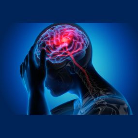 Clinical Botox for Migraine Headache Sufferers