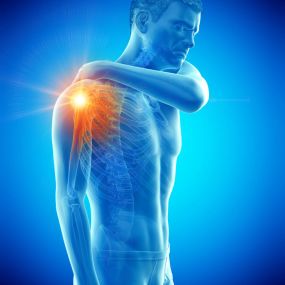 Shoulder Impingement Syndrome Treatment