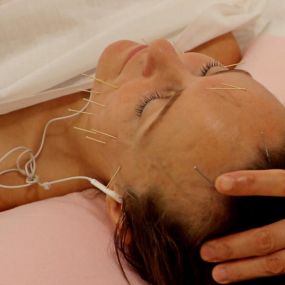 Bild von Pin Lu Acupuncture and Massage