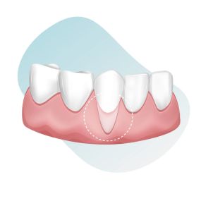 Bild von San Diego Periodontics & Implant Dentistry