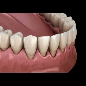 Bild von San Diego Periodontics & Implant Dentistry