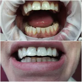 Dentální hygiena Pavlína Peterová, DiS