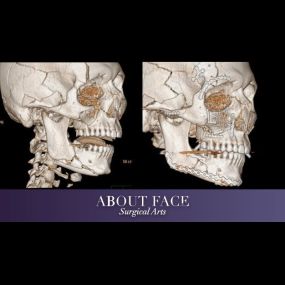 Bild von About Face Surgical Arts: Khurram A. Khan BDS, DMD