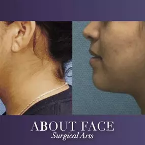 Bild von About Face Surgical Arts: Khurram A. Khan BDS, DMD