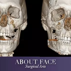 Bild von About Face Surgical Arts: Khurram A. Khan BDS, DMD