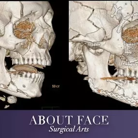 Bild von About Face Surgical Arts: Khurram A. Khan BDS, DMD