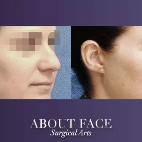 Bild von About Face Surgical Arts: Khurram A. Khan BDS, DMD