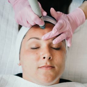 HydraFacial