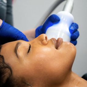 Cryoskin Facial