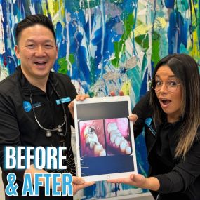 Experience Smile Transformation with Dr. Chang at Smile Avenue!