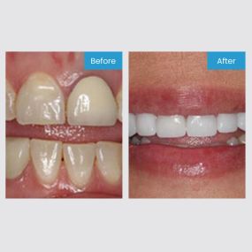 Smile More! Our custom planned individual care is the standard you have been looking for.