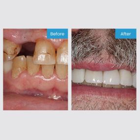 Smile More! Our custom planned individual care is the standard you have been looking for.