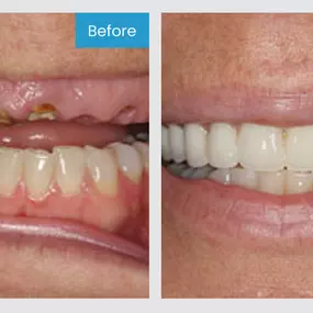 Smile More! Our custom planned individual care is the standard you have been looking for.